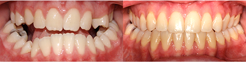 Mir-Mc-Frontal-BnA