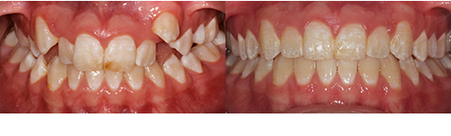 Sal-Ric-Frontal-BnA